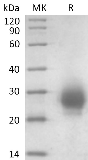 Cynomolgus CD32b +SDS-PAGE.jpg